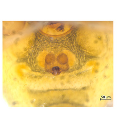Allothymoites sp. "Socketed Spines" © James Koh  • Epigyne • Ventral • ♀ • Adult